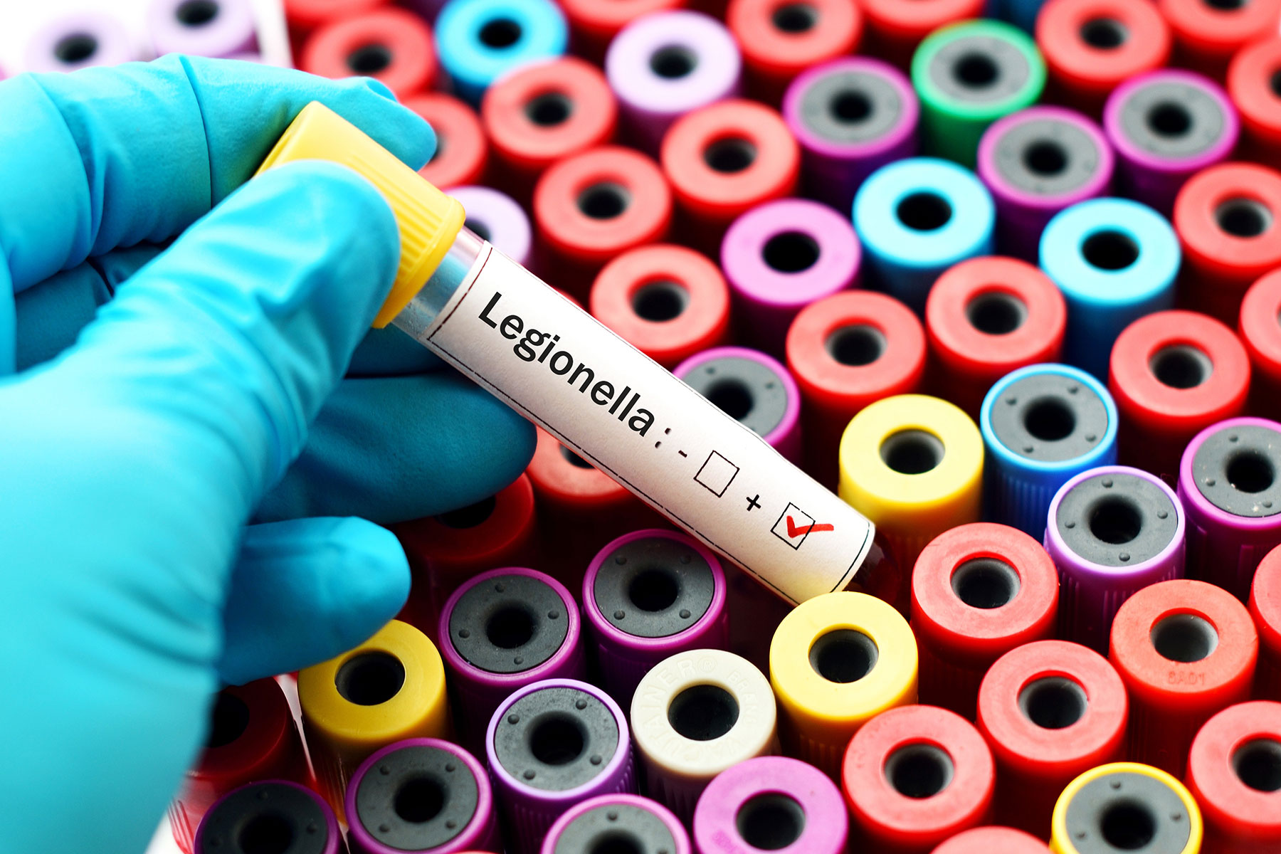 Legionella pod lupou: Komplexní průvodce hodnocením rizik a prevencí proti výskytu